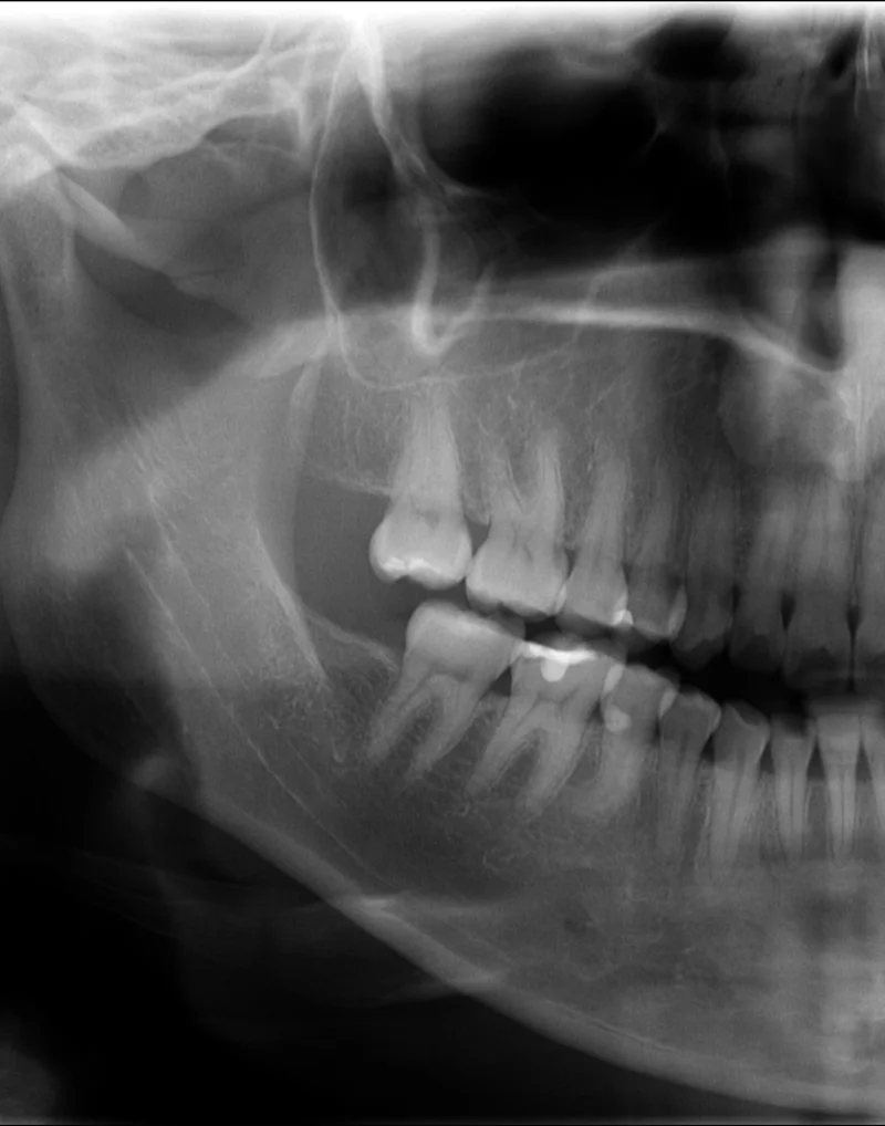 Radiografia panorâmica odontológica